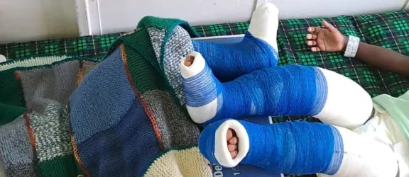 Kinder nach der OP im Aufwachraum