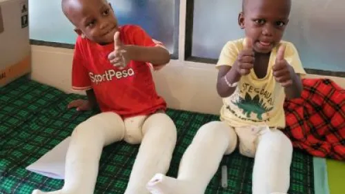 Zwillinge nach der OP