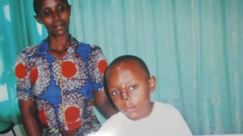 projekt-feuerkinder-daniel-nach-nasenkorrektur